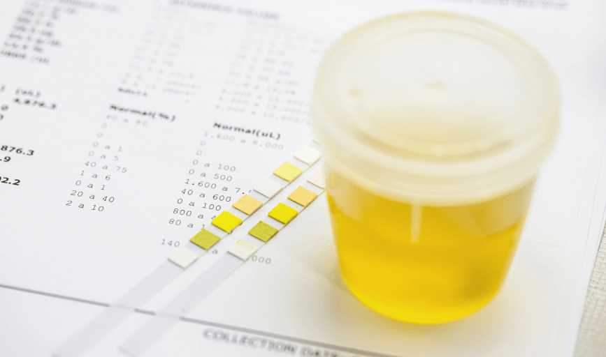 NON-DOT DRUG TESTING